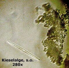 Kieselalge von oben, 280x. Das nackte Auge sieht mehr...